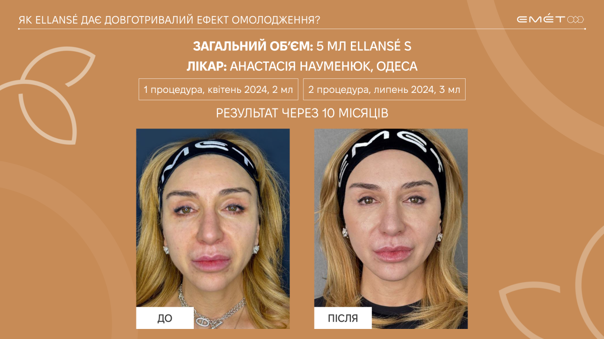 Що найбільше зволожує шкіру обличчя?